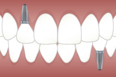 teeth-3597679__480